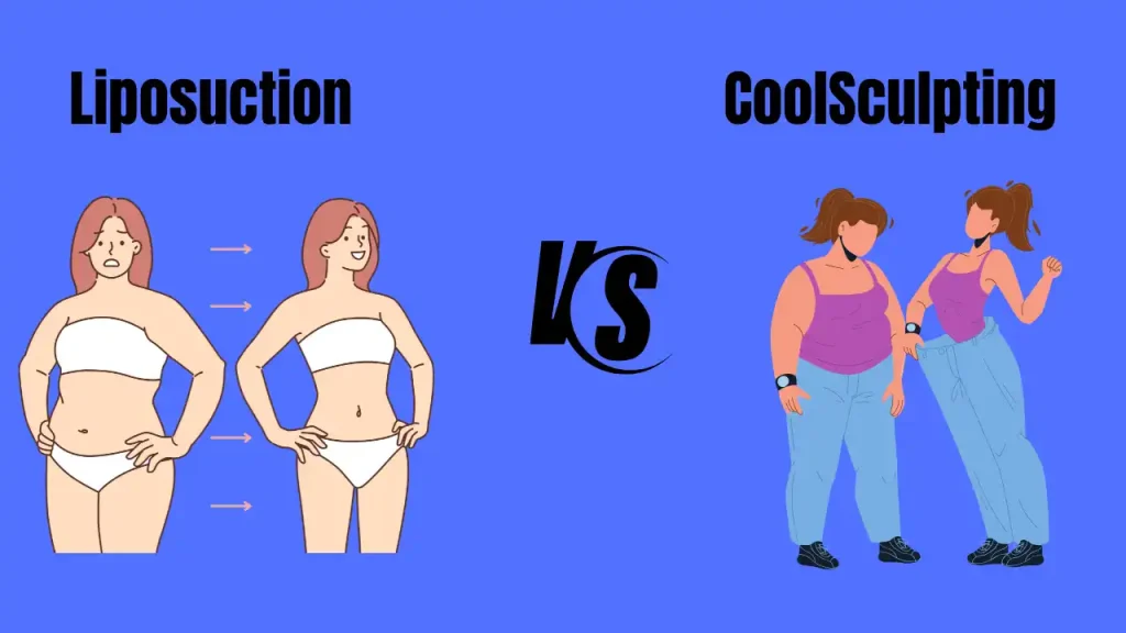 liposuction chicago