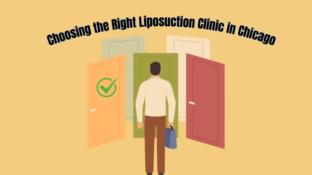 liposuction chicago