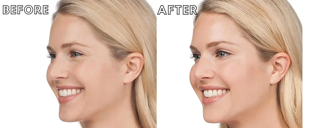 botox specials near me