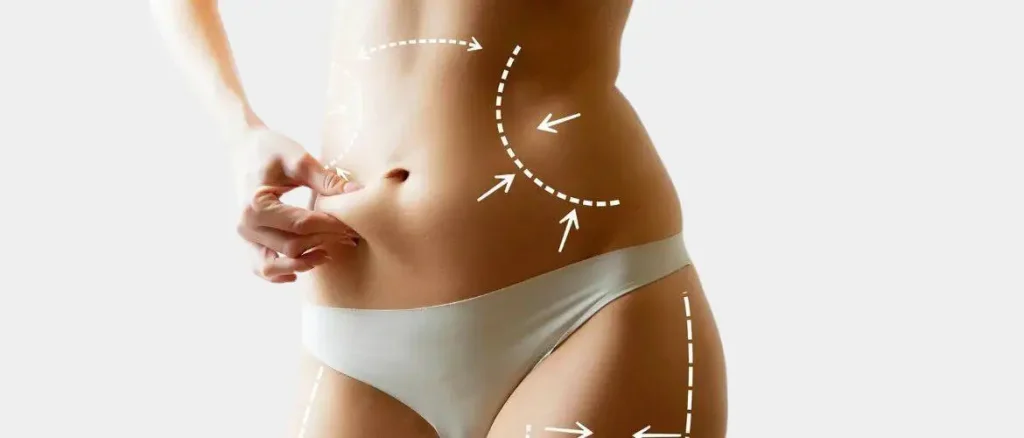 liposuction nyc
