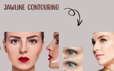 Jawline Contouring in Chicago for a Sculpted Look Jawline Contouring in Chicago for a Sculpted Look