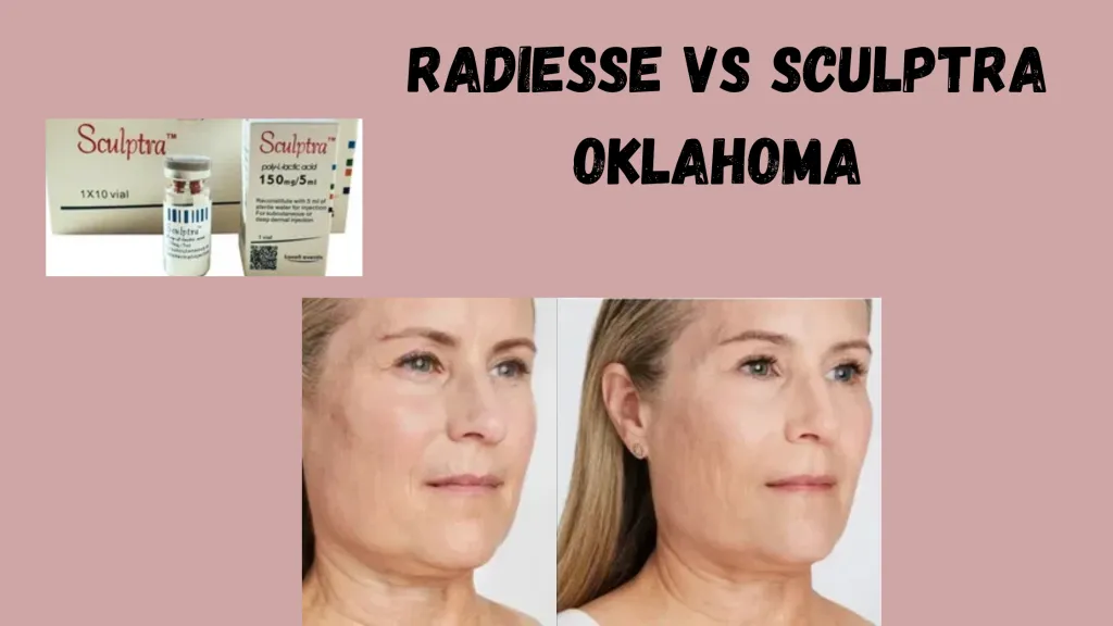 Radiesse Vs Sculptra Oklahoma 1